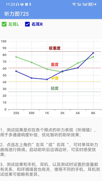 智听鸿蒙版截图5