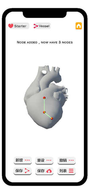 冠脉造影模拟器iPhone版截图2