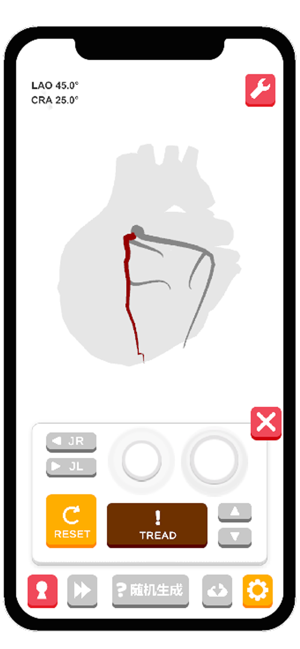 冠脉造影模拟器iPhone版截图1