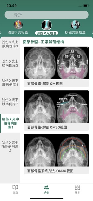 影像图谱iPhone版截图3