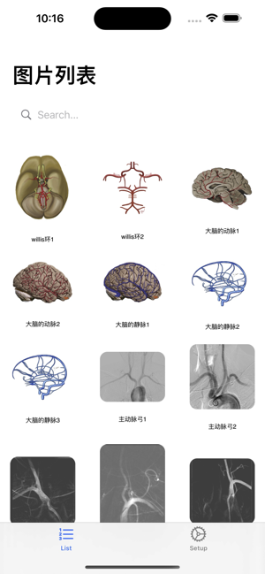 脑血管学习iPhone版截图1