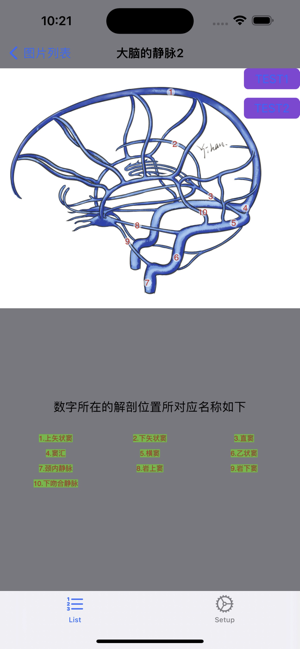 脑血管学习iPhone版截图3