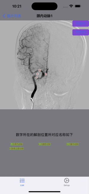 脑血管学习iPhone版截图8