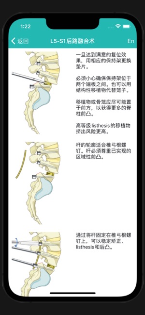 脊柱创伤iPhone版截图3