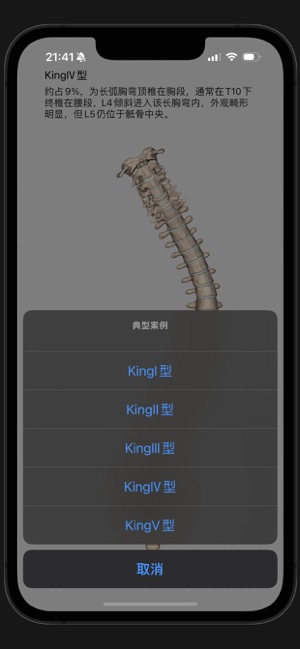 脊柱侧弯iPhone版截图4