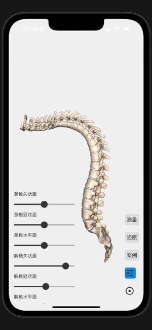 脊柱侧弯iPhone版截图5