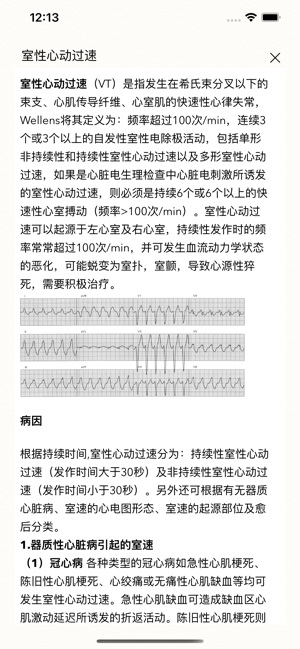 ECG心电图书ProiPhone版截图2