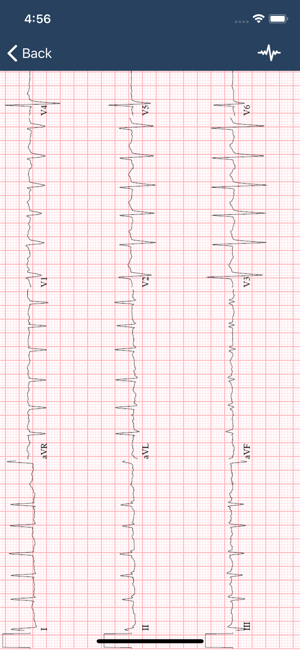 ECGGuideiPhone版截图3