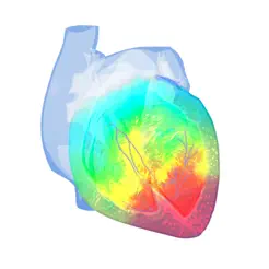 EpicardioHeartSimulatoriPhone版