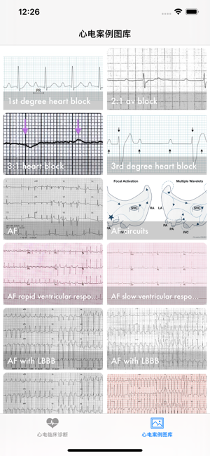 心电ECGAiPhone版截图4
