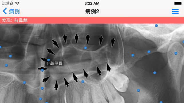 iPanoramiciPhone版截图4