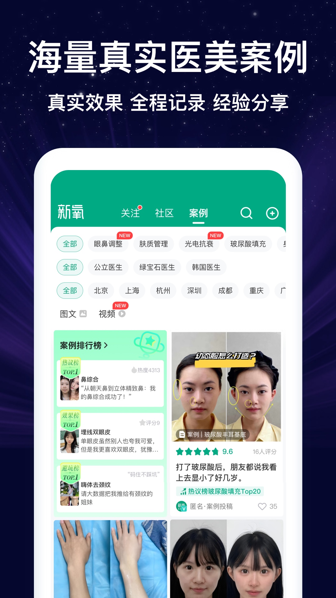 新氧医美截图4
